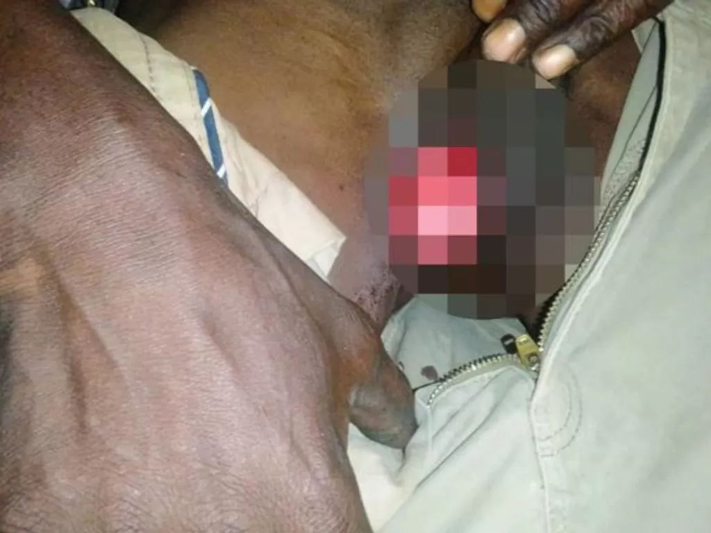 Viral istri gigit penis suami hingga luka parah. (Photo/Daily Star)