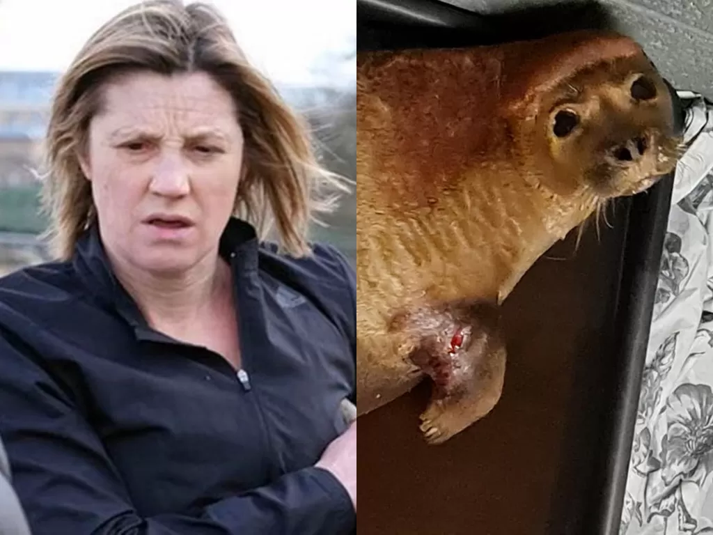 Pemilik anjing buas yang menggigit anjing laut. (Photo/Facebook/South Essex Wildlife Hospital/Mirror)