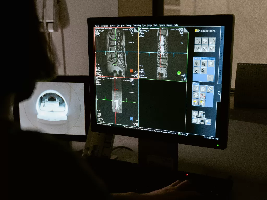 Tampilan ilustrasi teknologi ultrasound. (photo/Ilustrasi/Pexels/MART PRODUCTION)