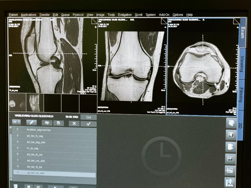 Hasil CT-Scan tulang belakang. (photo/Ilustrasi/Pexels/MART PRODUCTION)