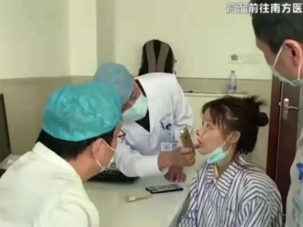 Petugas medis di salah satu rumah sakit di Guangzhou, China, memeriksa kondisi hidung aktris Gao Liu yang melepuh setelah menjalani operasi plastik. (ANTARA/Istimewa)