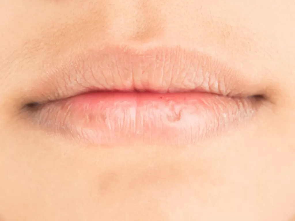 Ilustrasi cara mengatasi bibir kering saat puasa (photo/freepik/sri-sakorn42)