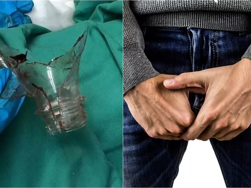 Penis pria tersangkut di botol plastik (Facebook/Info Roadblock JPJ/POLIS/Ilustrasi/Pixabay)
