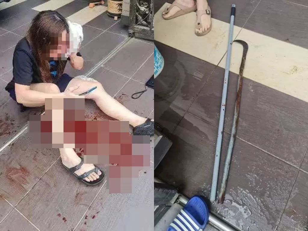 Seorang wanita terluka karena celurit tetangga. (Photo/Facebook/Info Roadblock JPJ/POLIS)