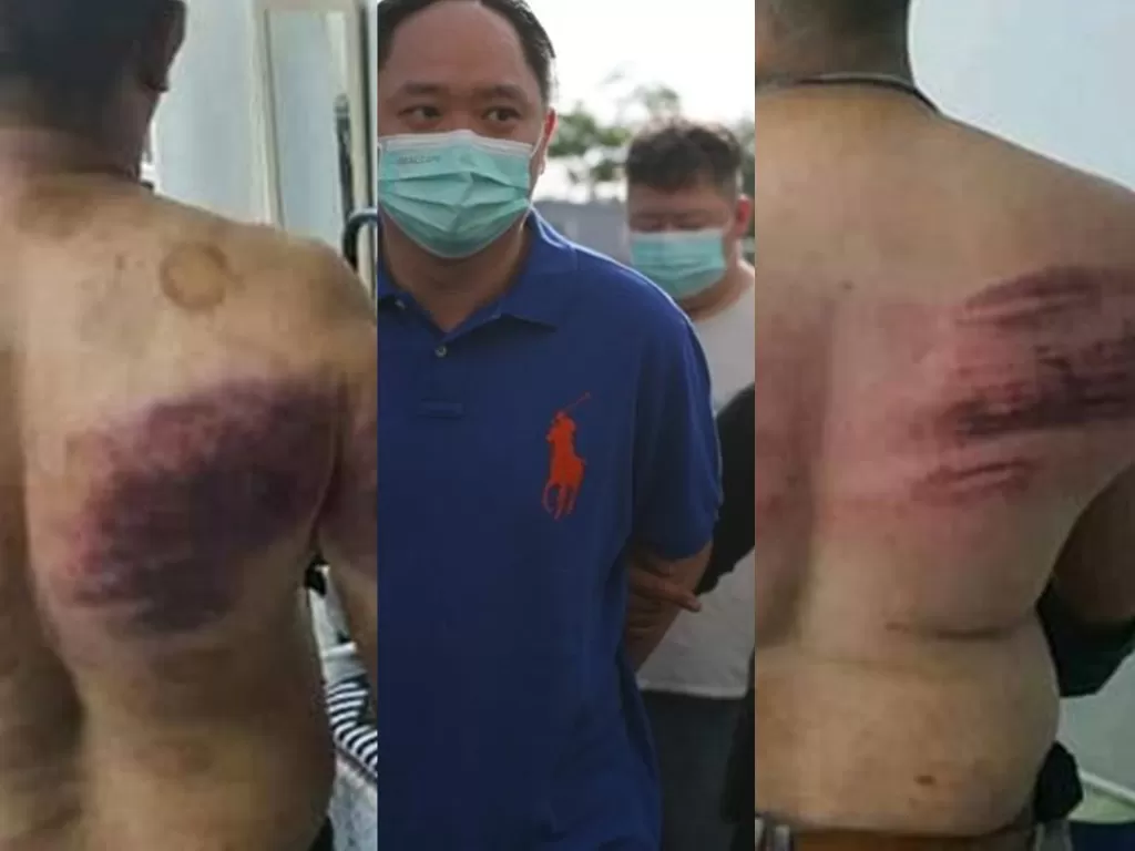 Dua pengawal yang mengalami memar setelah dipukul karena mereka berpuasa. (Photo/Facebook/Astro Anawi/Twitter)