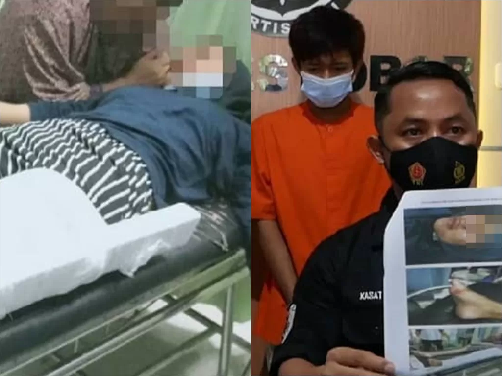 Wanita jadi korban begal di Lombok Barat alami patah kaki dan luka di sekujur tubuh (Instagram/instalombok_)