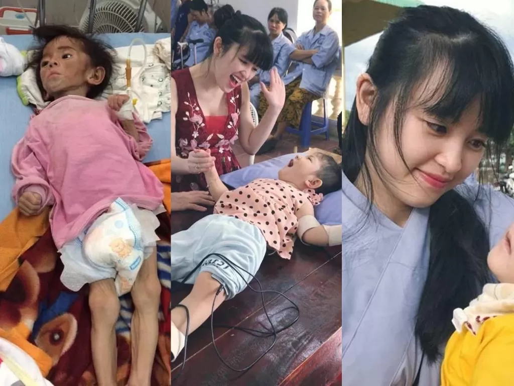 Gadis muda yang merawat bayi cerebral palsy. (Photo/HK News)