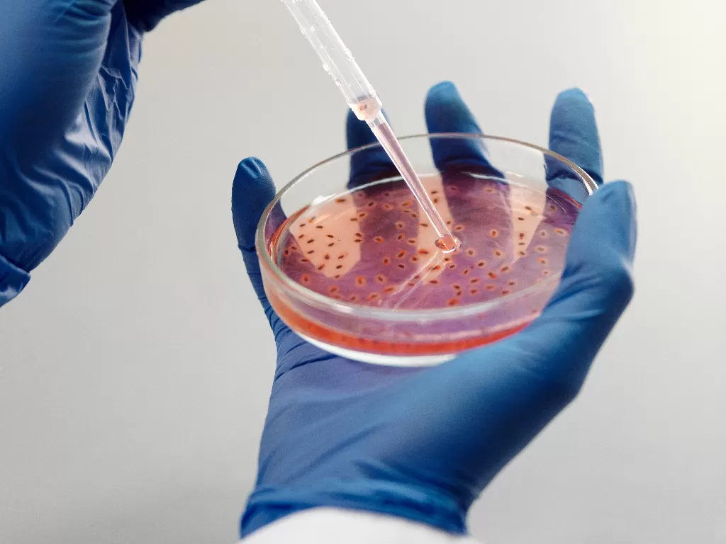 Ilustrasi penelitian mikroba. (photo/Ilustrasi/Pexels/Edward Jenner)