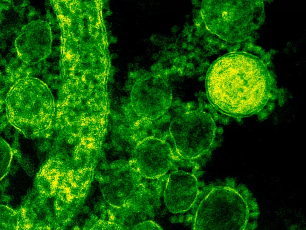 Ilustrasi bakteri. (photo/Ilustrasi/Pexels/CDC)