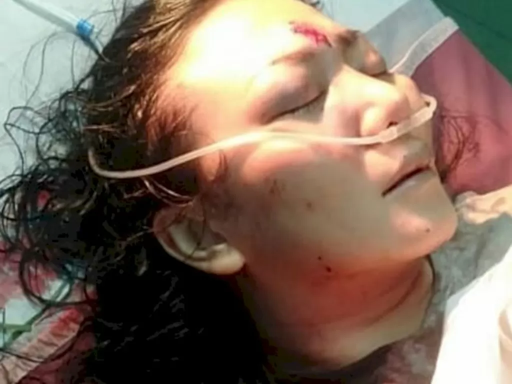 Wanita yang jadi korban penganiayaan ojek pangkalan (Instagram).