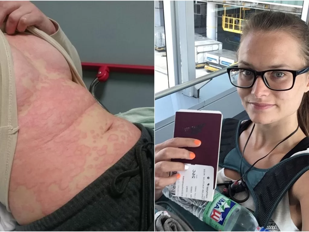 Penyakit wanita ini sembuh setelah liburan keliling dunia. (SWNS.com)