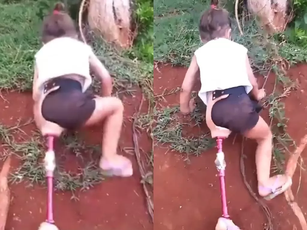 Gadis ini pakai kaki prostetik, semangatnya bikin haru. (Photo/Twitter/@GoodNewsCorres1)