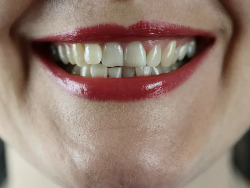 Penyebab gigi kuning (unsplash/@jccards)