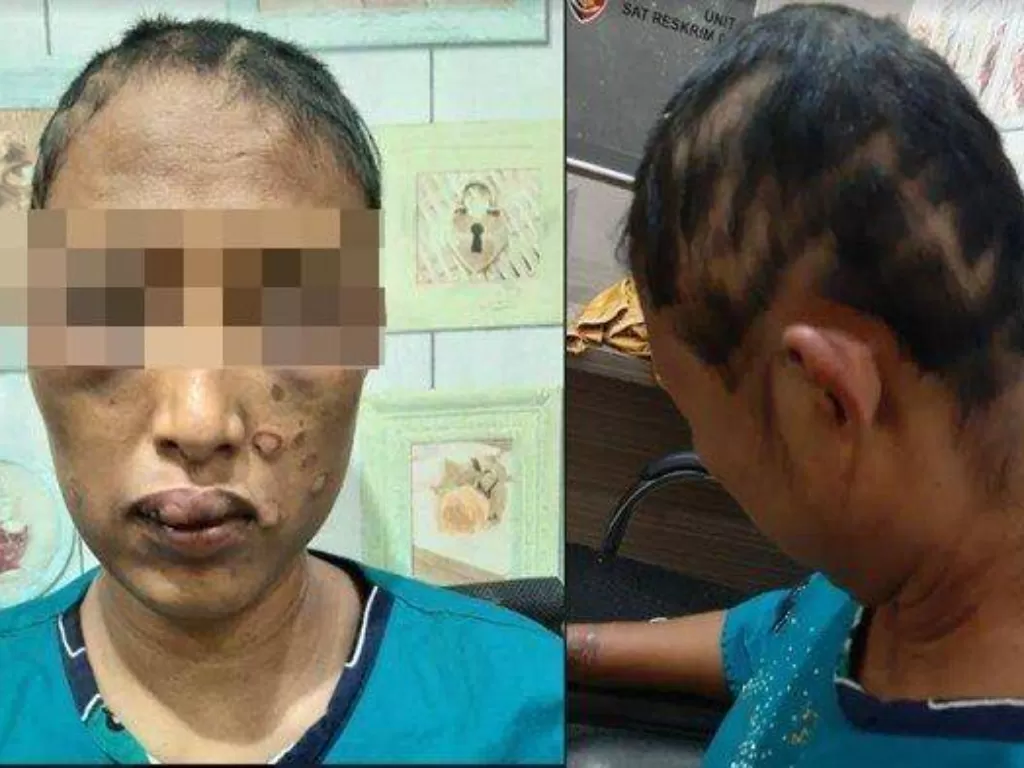 RN (44 tahun), wanita yang dianiaya suami sirinya di Banyuasin. (Ist.)