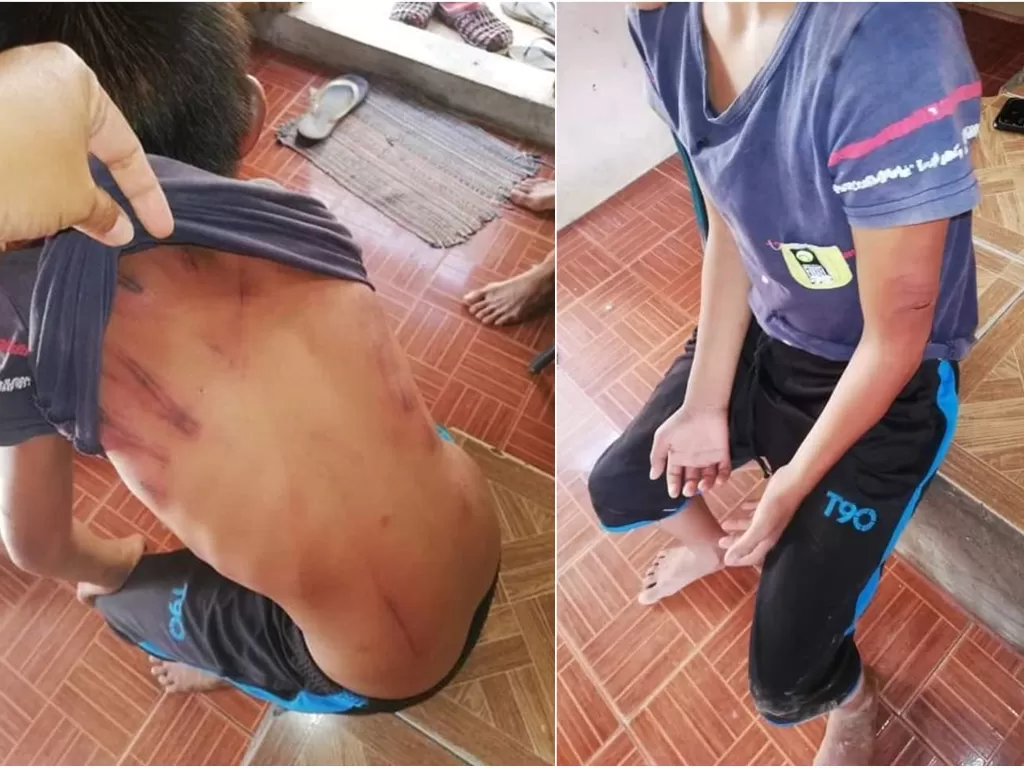 Bocah 10 tahun di Malaysia disiksa saudaranya sendiri. (Facebook/Info Roadblock JPJ/POLIS)