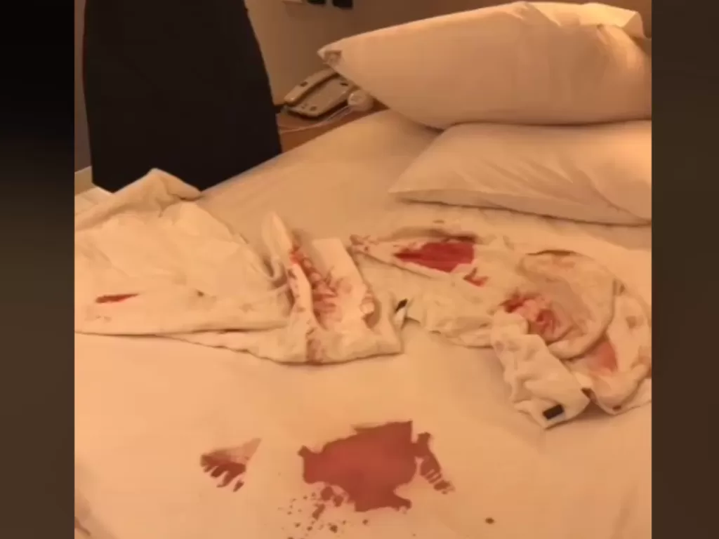 Kasur hotel banyak bercak darah viral (Tiktok)