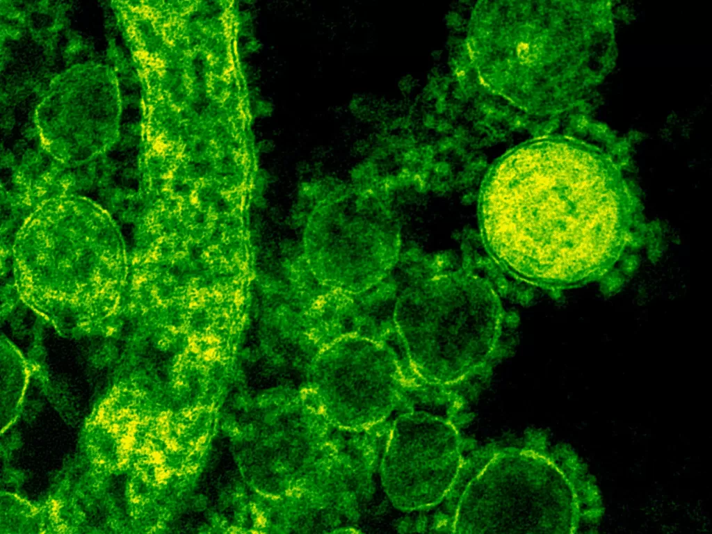 Ilustrasi virus. (Pexels/CDC)