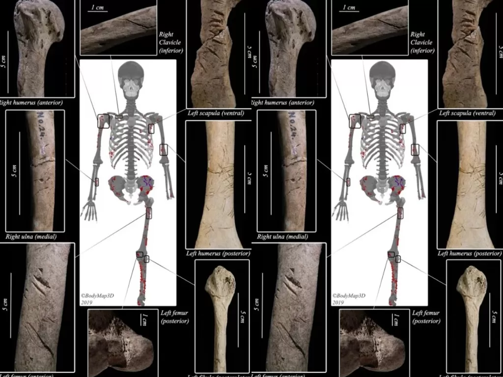 Tampilan tulang seorang pria yang tewas mengenaskan dari hiu. (photo/Dok. White et al., J. Archaeol. Sci. Rep., 2021/JAW, Coutersy of Kyoto University)