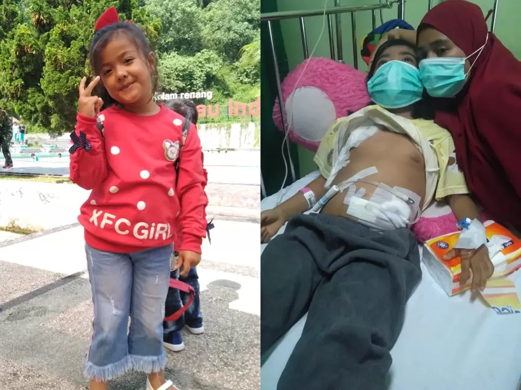 Nayla Syawal Henly menderita Gagal Ginjal Kronis. (Photo/Yayasan Minang Care Indonesia)