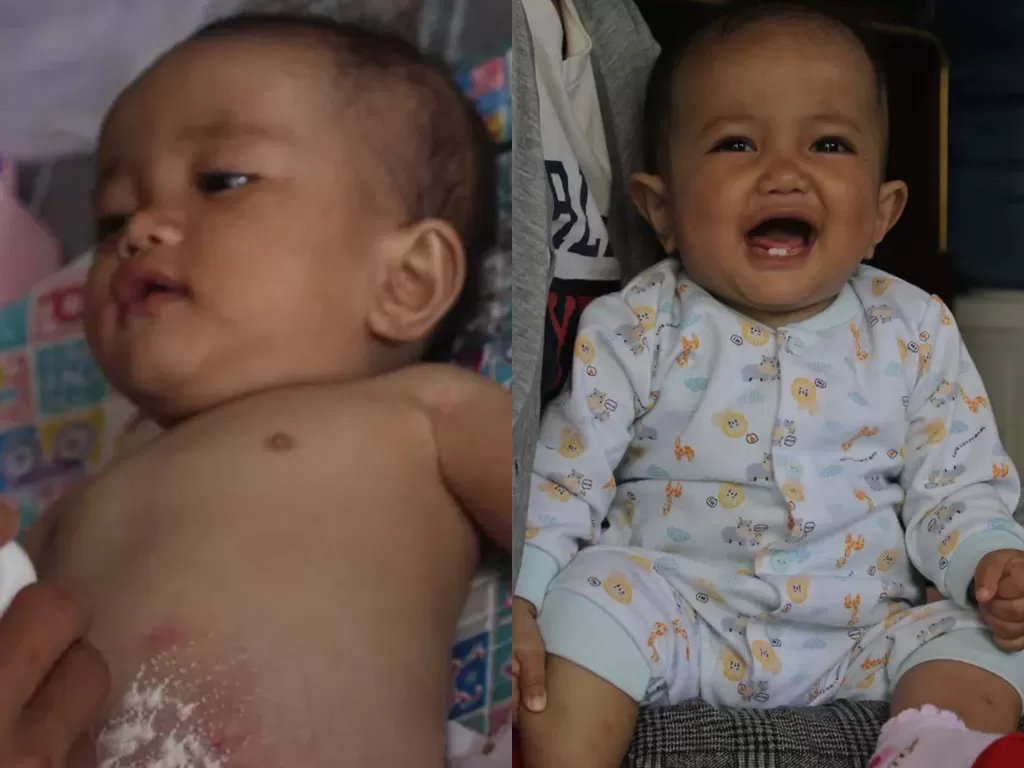 Bocah berusia 11 bulan yang bernama Nilam Humairah Brilian Khairul Nissa menderita penyakit yang aneh. (Photo/Yuk Peduli)