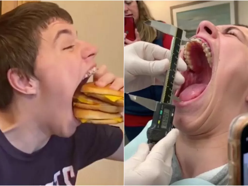 Isaac Johnson, remaja yang memiliki mulut terlebar. (TikTok/@guinnessworldrecords)