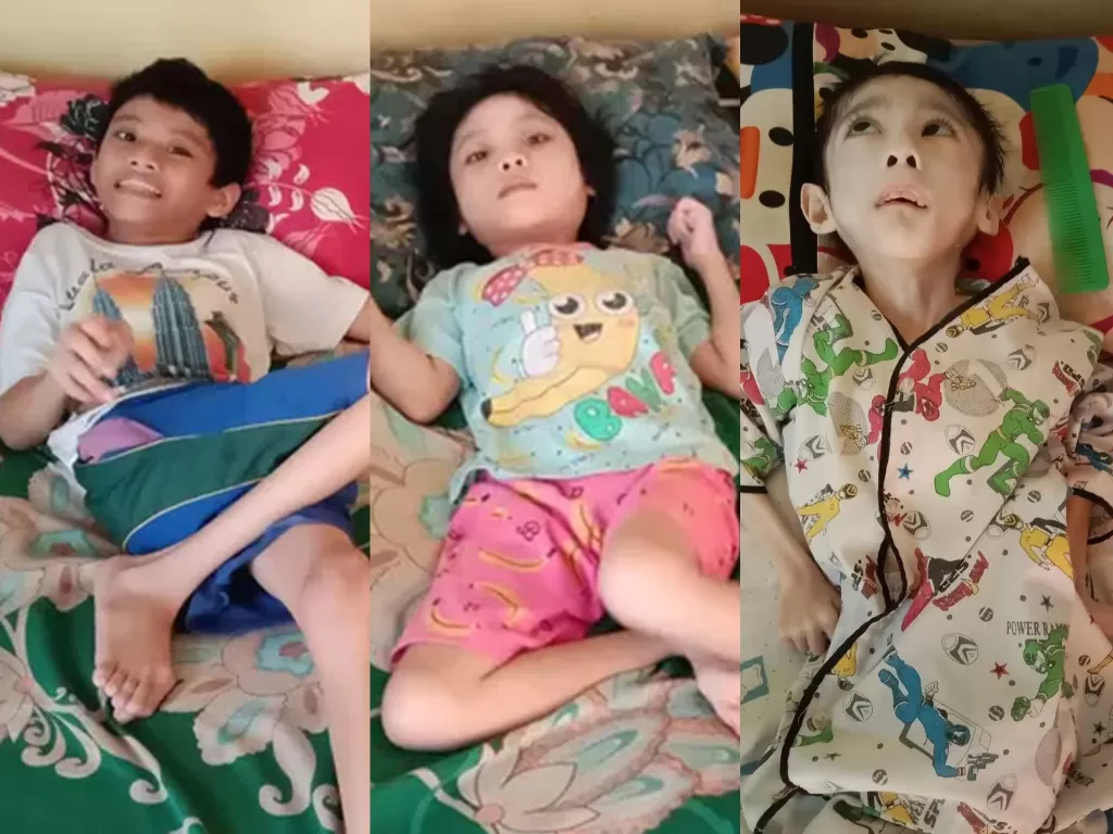 Tiga anak ini mengalami cerebral palsy. (Photo/Insan Bumi Mandiri)