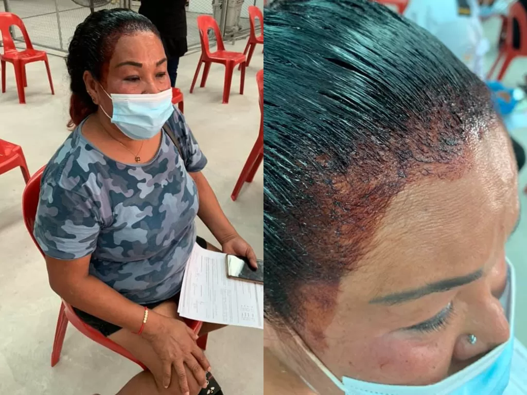 Wanita ini lupa cat rambutnya berantakan akibat terburu-buru ingin vaksinasi. (Photo/Facebook/Thian Siew Kim)