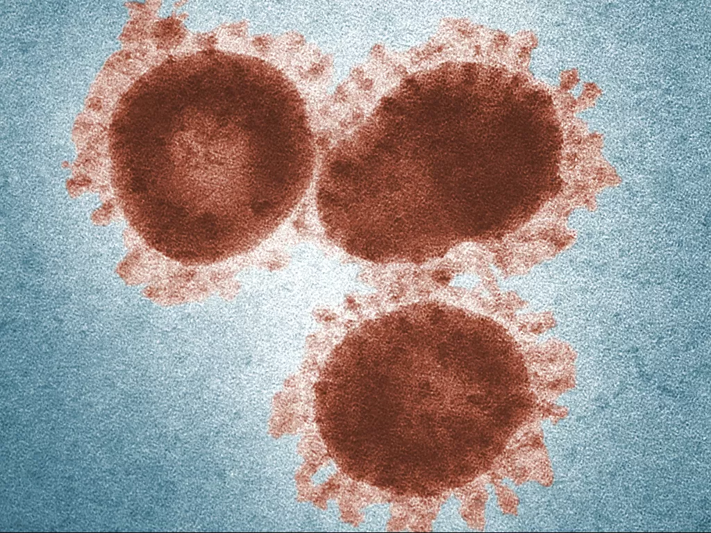 Ilustrasi virus. (photo/Ilustrasi/Pexels/CDC)