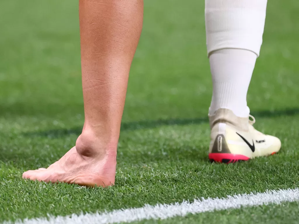Pergelangan kaki gelandang Spanyol, Dani Ceballos bengkak akibat ditekel pemain Mesir di Olimpiade Tokyo. (photo/REUTERS/KIM HONG-JI)
