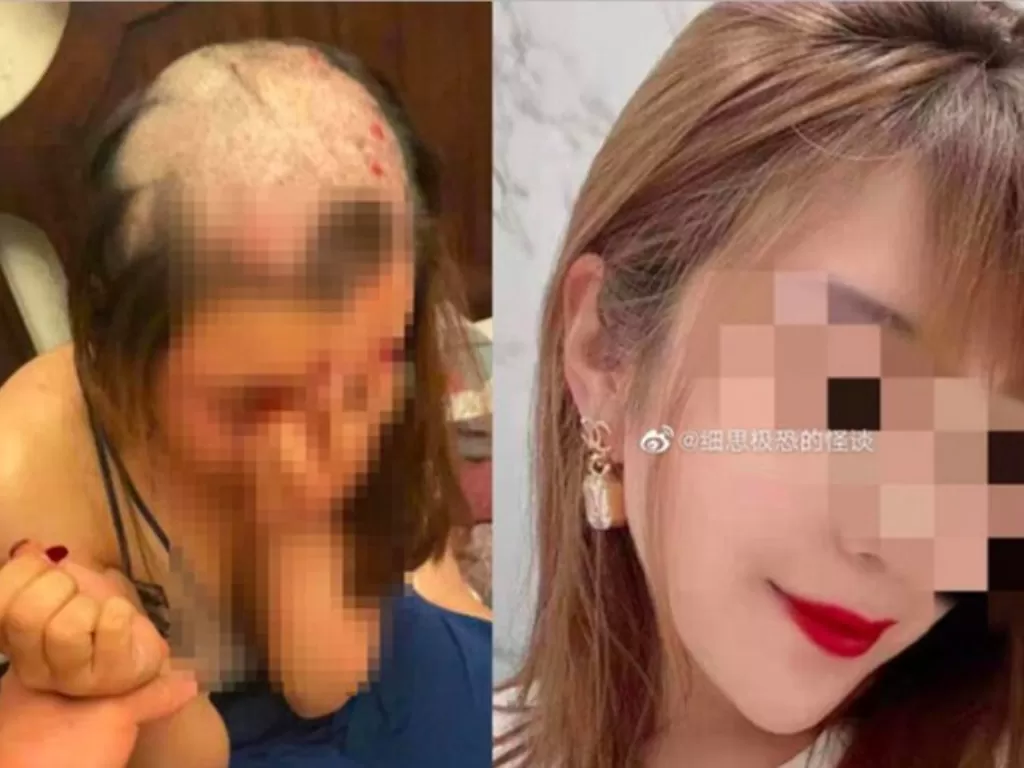 Tampilan wanita yang kepalanya botak usai dicukur suaminya. (photo/Dok. China Press)