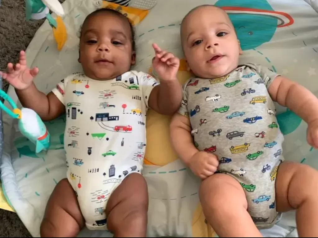 Bayi kembar dengan warna kulit yang berbeda. (Ladbible)