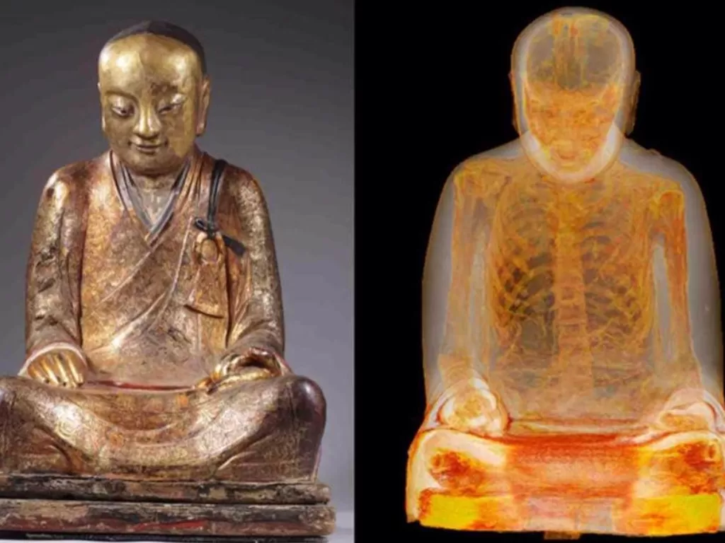 Patung buddha berisi mumi biksu (Facebook/Radiopaedia.org)