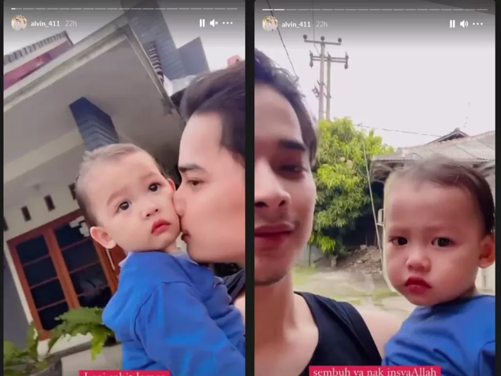 Alvin Faiz cium anak Zikri Daulay yang sedang sakit. (Instagram/@alvin_411)