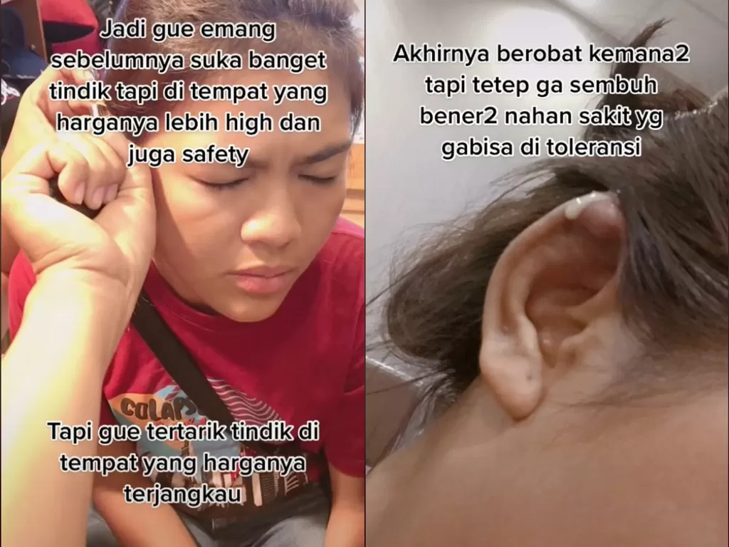 Wanita bagikan kisahnya yang menyesal karena tergiur tindik telinga murah (TikTok/jinekkkkk)