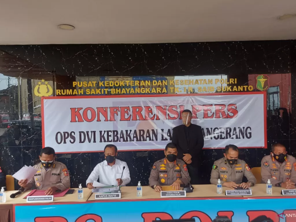 Jumpa pers kasus kebakaran Lapas Tangerang di RS Polri Kramat Jati, Jakarta, Senin (13/9/2021). (ANTARA/Yogi Rachman)