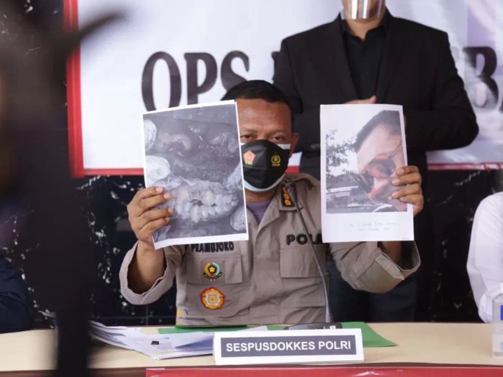 Konferensi pers Mabes Polri terkait identifikasi 8 jasad korban kebakaran Lapas Tangerang di RS Polri, Jaktim. (Dok Divisi Humas Mabes Polri)