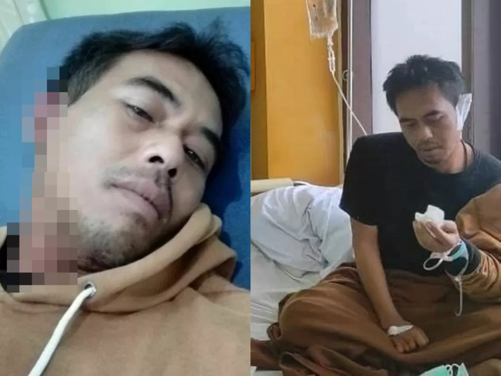 Atlet disabilitas dipalak dan dianiaya 2 preman di Bandung (Instagram/beritakotabandung)