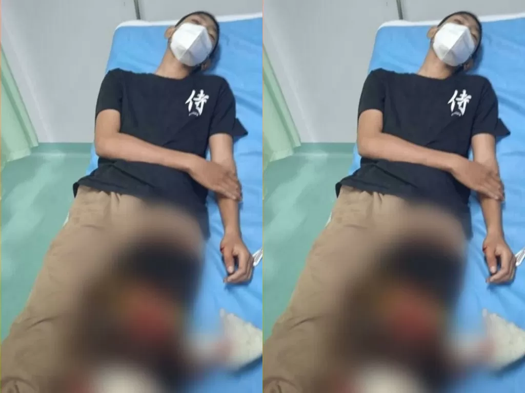 Remaja 15 tahun jadi korban begal di Tangsel (Instagram)