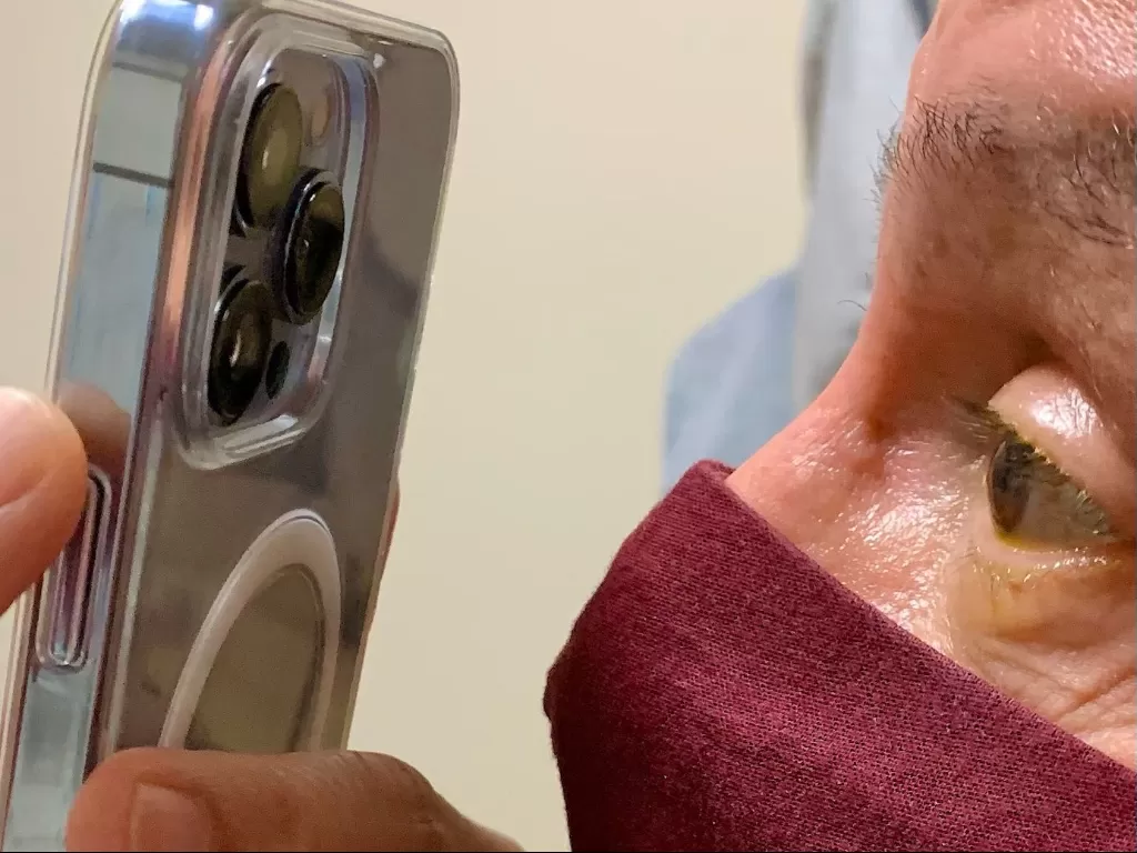 Dokter pakai iPhone 13 untuk cek mata pasien (photo/LinkedIn/Tommy Korn)