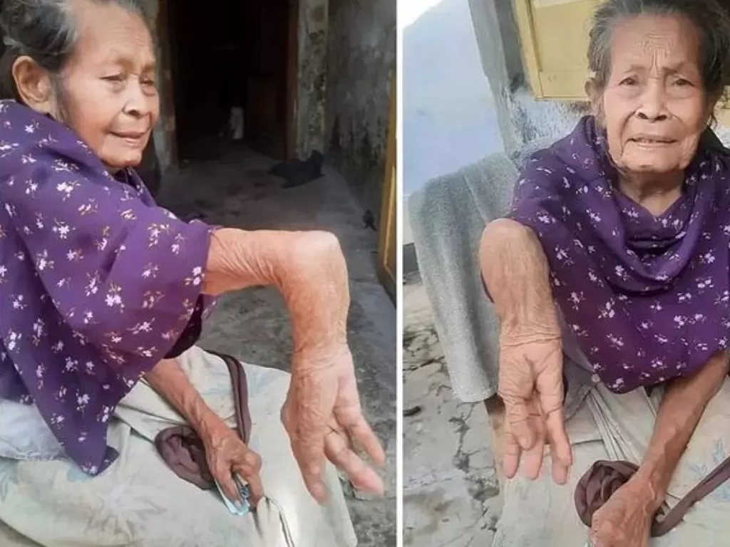 Kisah pilu Nenek Demi yang hidup sebatang kara dengan kondisi tangan patah puluhan tahun (Instagram/uncle_teebob)