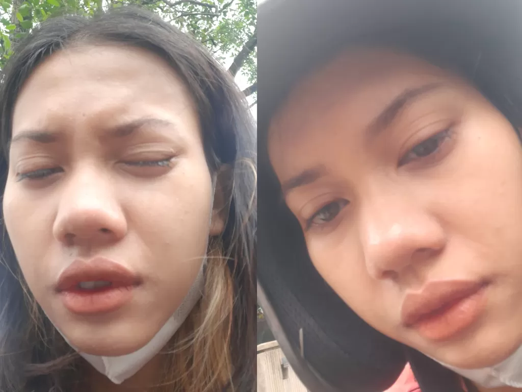 Kisah wanita yang matanya kena bara rokok di jalan (Twitter/@AkunFirda)