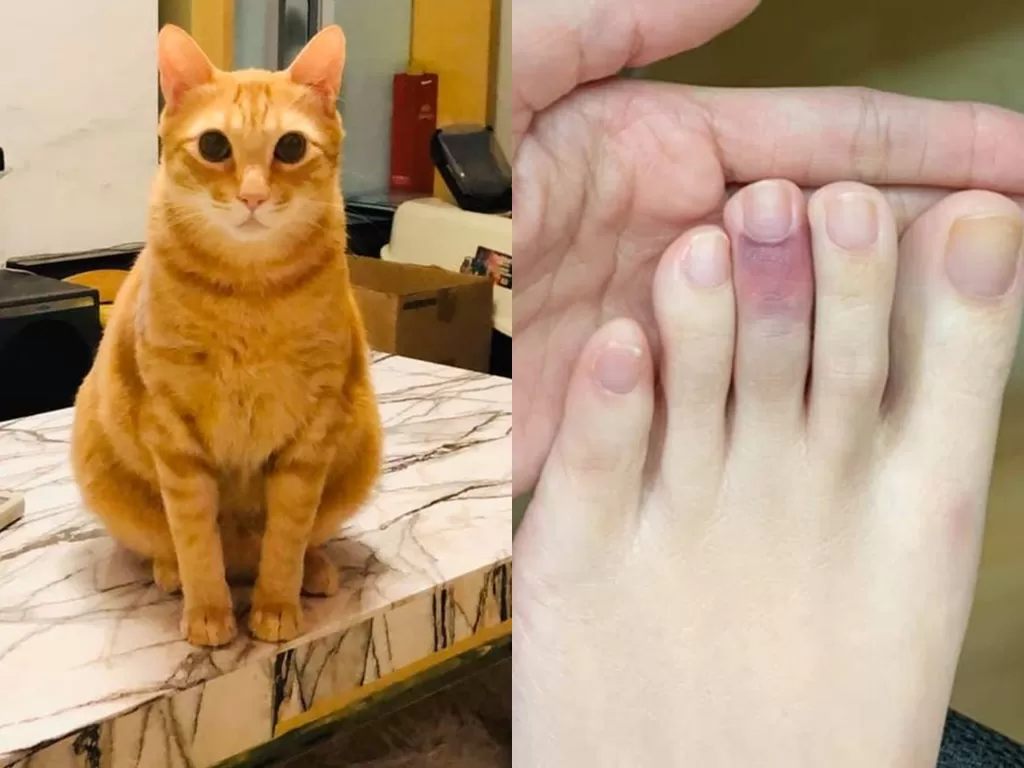 Jari kaki pemilik kucing oren ini bengkak karena tersandung perutnya yang gemuk. (Photo/HK01)