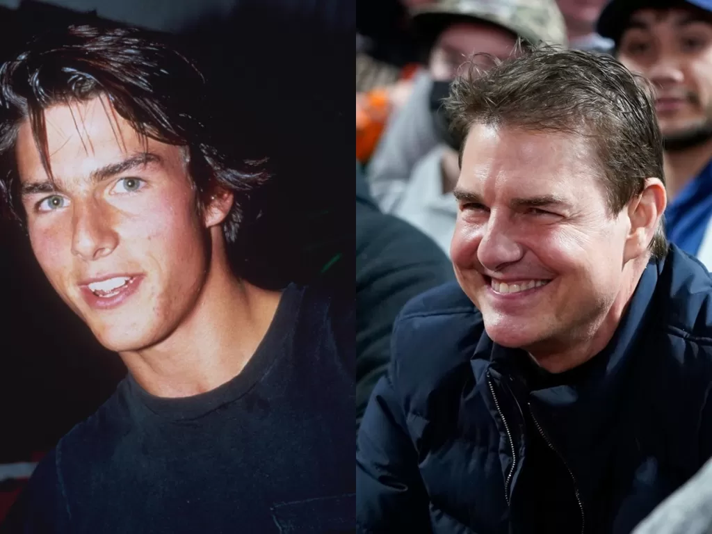Potret perbedaan wajah Tom Cruise. (Foto/The Sun)
