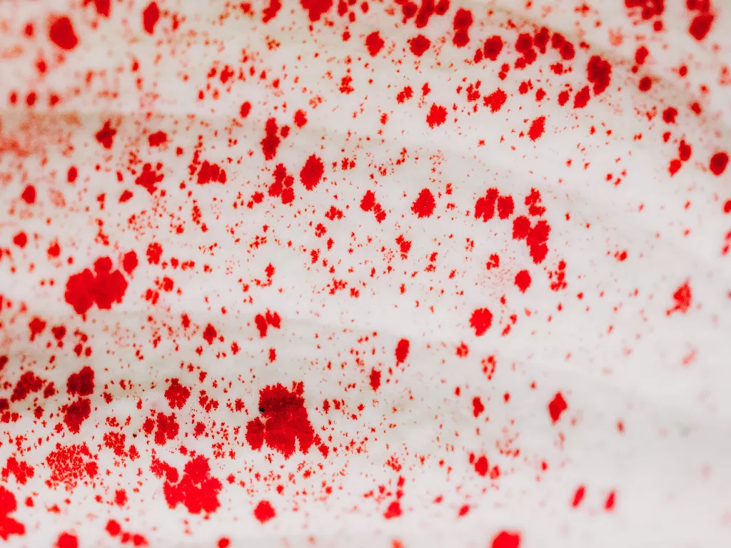 Ilustrasi darah (Photo by Karolina Grabowska from Pexels)
