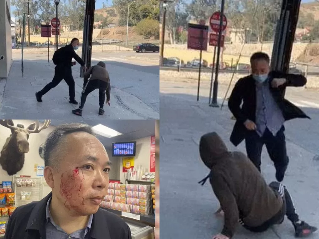 Seorang profesor di China melawan seorang pria dengan jurus kung fu (Baidu)