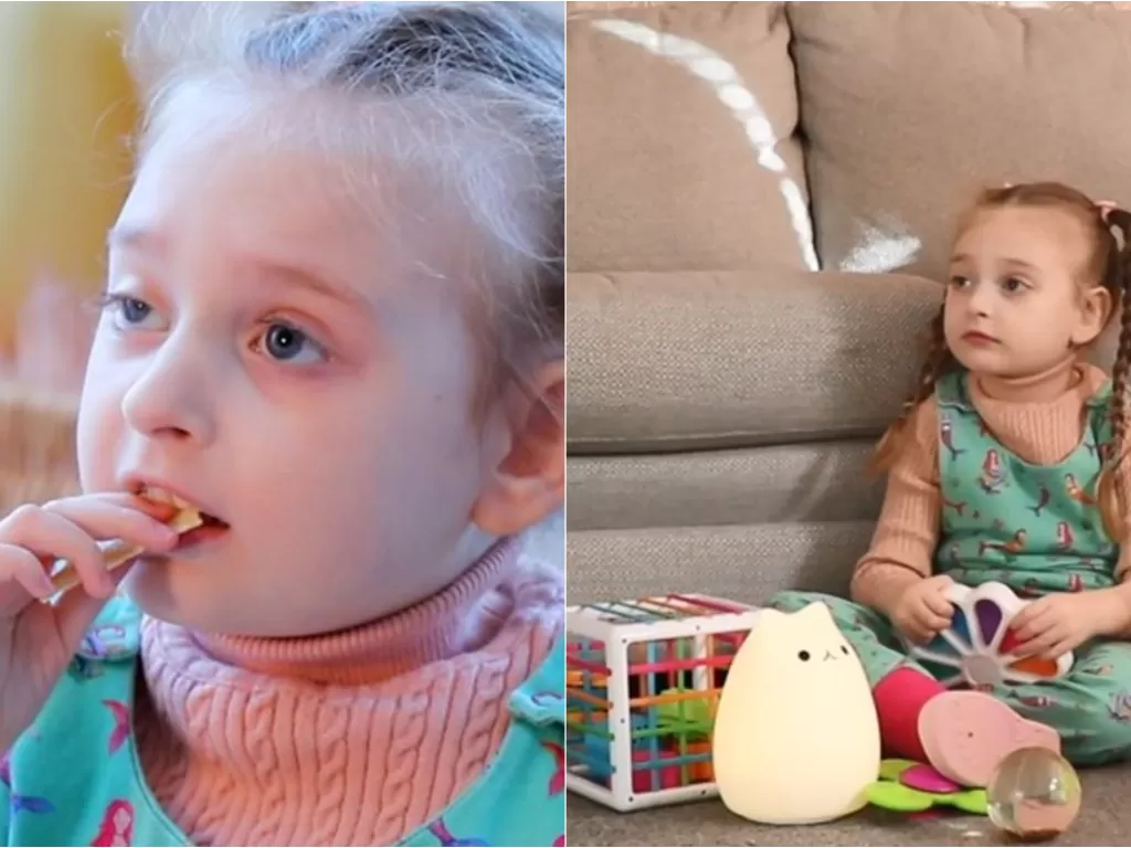 Ava, anak yang punya sindrom  cohen dan hanya bisa makan keripik. (Foto/BBC)
