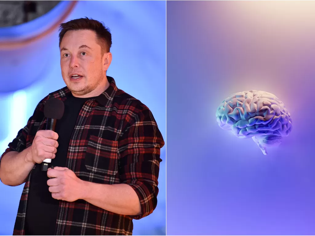 Kiri: Elon Musk (Robyn Beck/Pool via REUTERS) / Kanan: Ilustrasi otak (Unsplash/Fakurian Design)