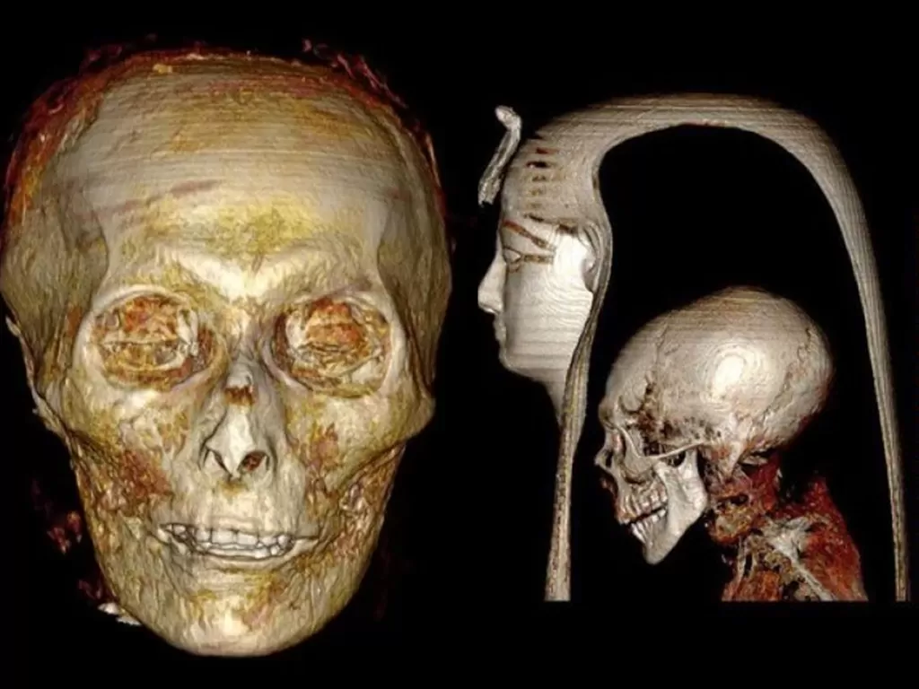 Hasil CT scan ini menunjukkan tengkorak Firaun Mesir Amenhotep I. Para peneliti Mesir 