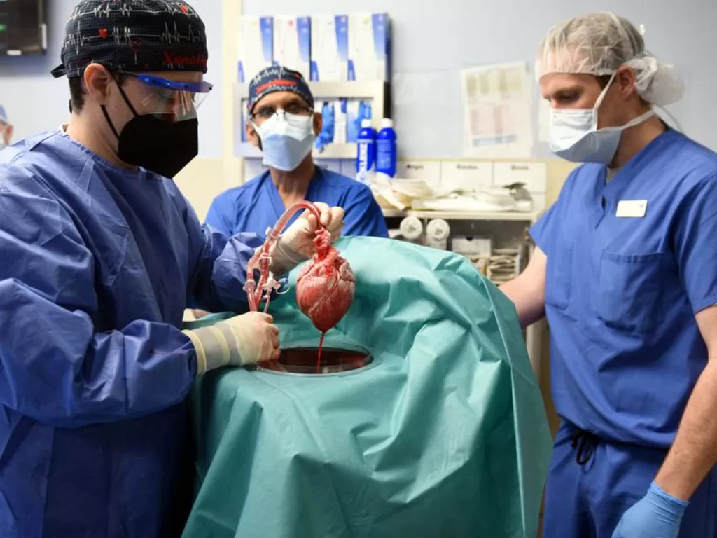 Tim transplantasi jantung babi Universitas Maryland menunjukkan jantung babi yang mereka cangkokkan ke tubuh David Bennett. (Foto: Reuters)