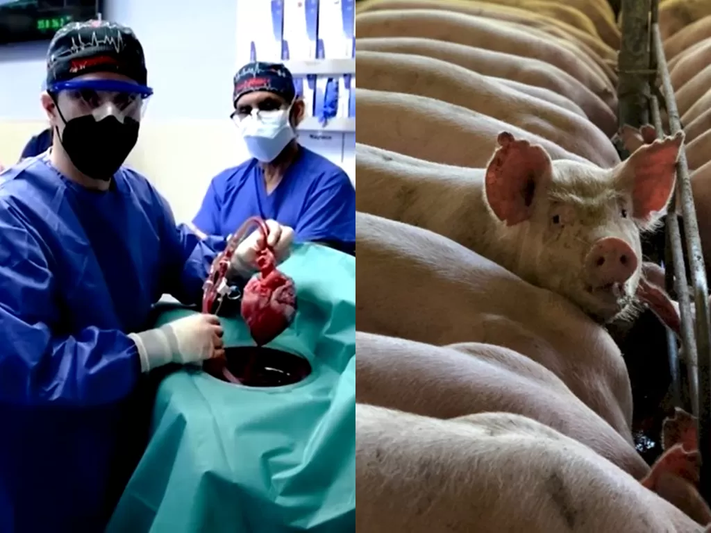 Kiri: Tim transplantasi jantung babi Universitas Maryland (Foto: Reuters), kanan: ilustrasi babi (Barbara Barbosa dari Pexels)